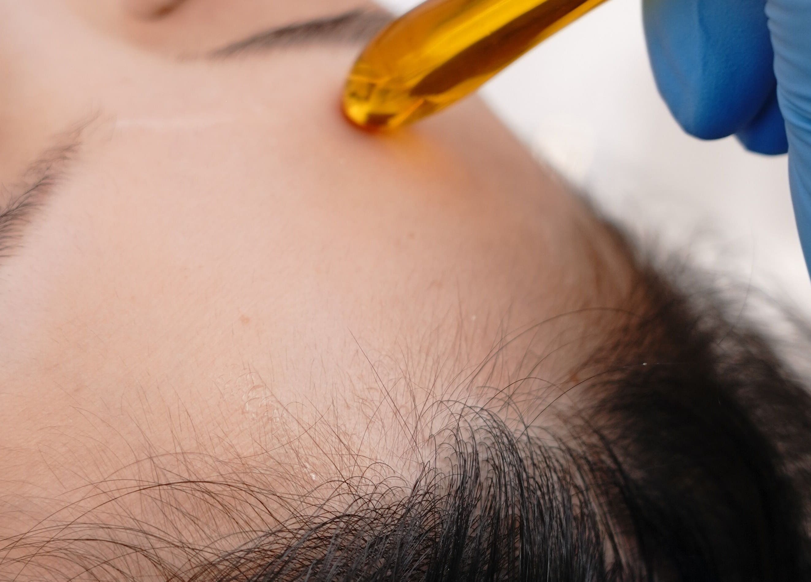 Facial therapy using golden serum at BB Media, Markham, Ontario, CA. Enhancing beauty and wellness.