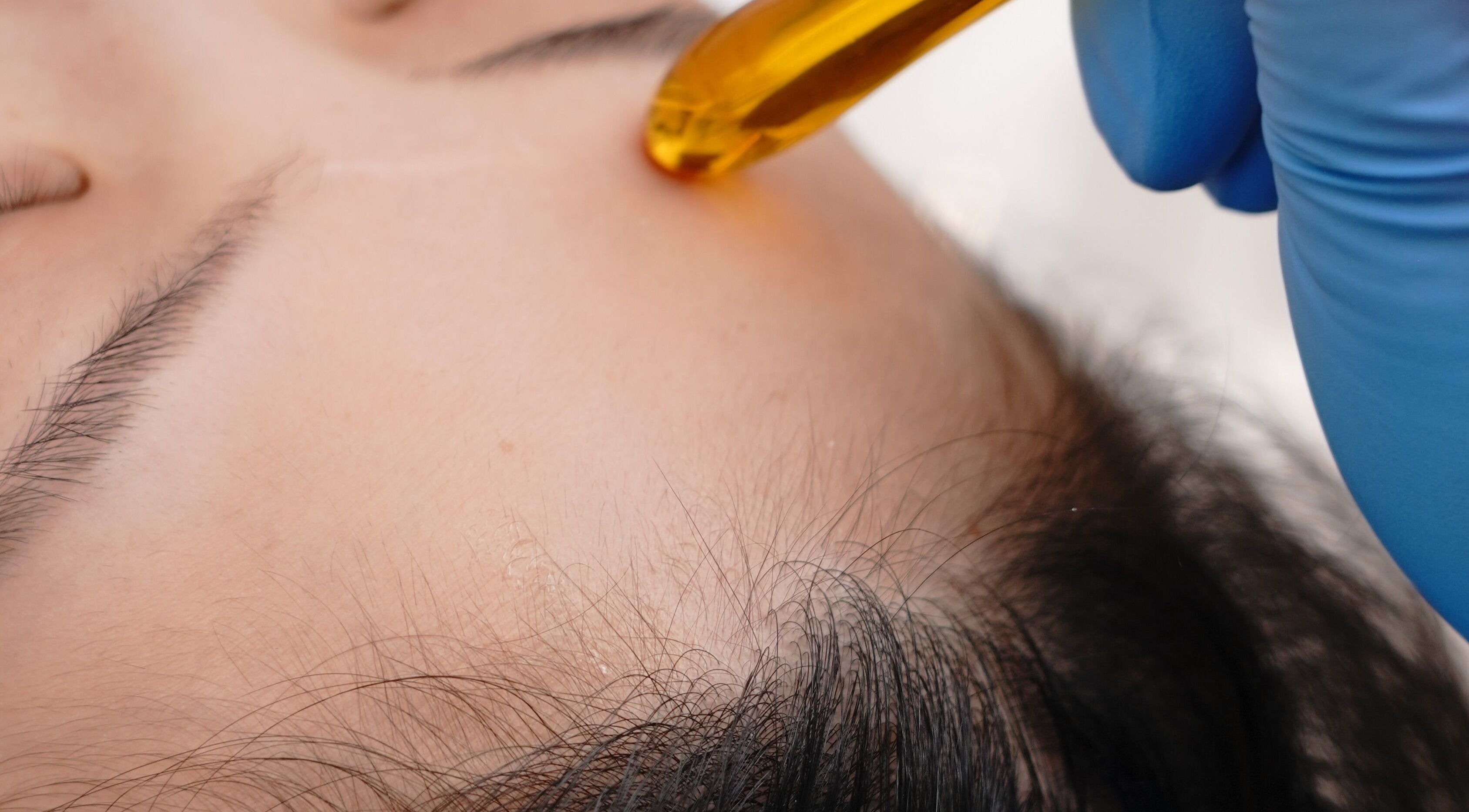 Facial therapy using golden serum at BB Media, Markham, Ontario, CA. Enhancing beauty and wellness.