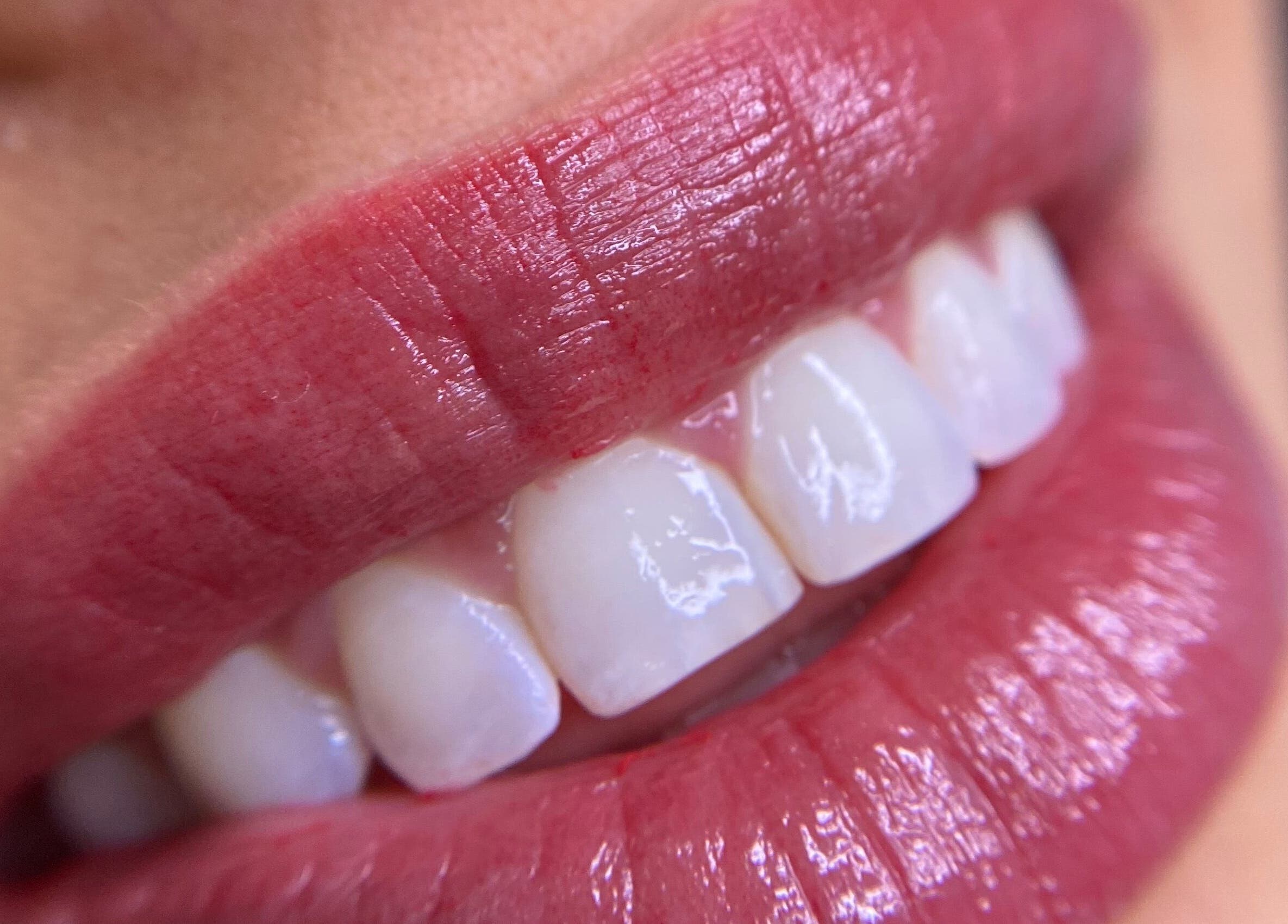 Close de lábios e dentes brilhantes no Kamille Macagnani, Porto, Porto, PT.