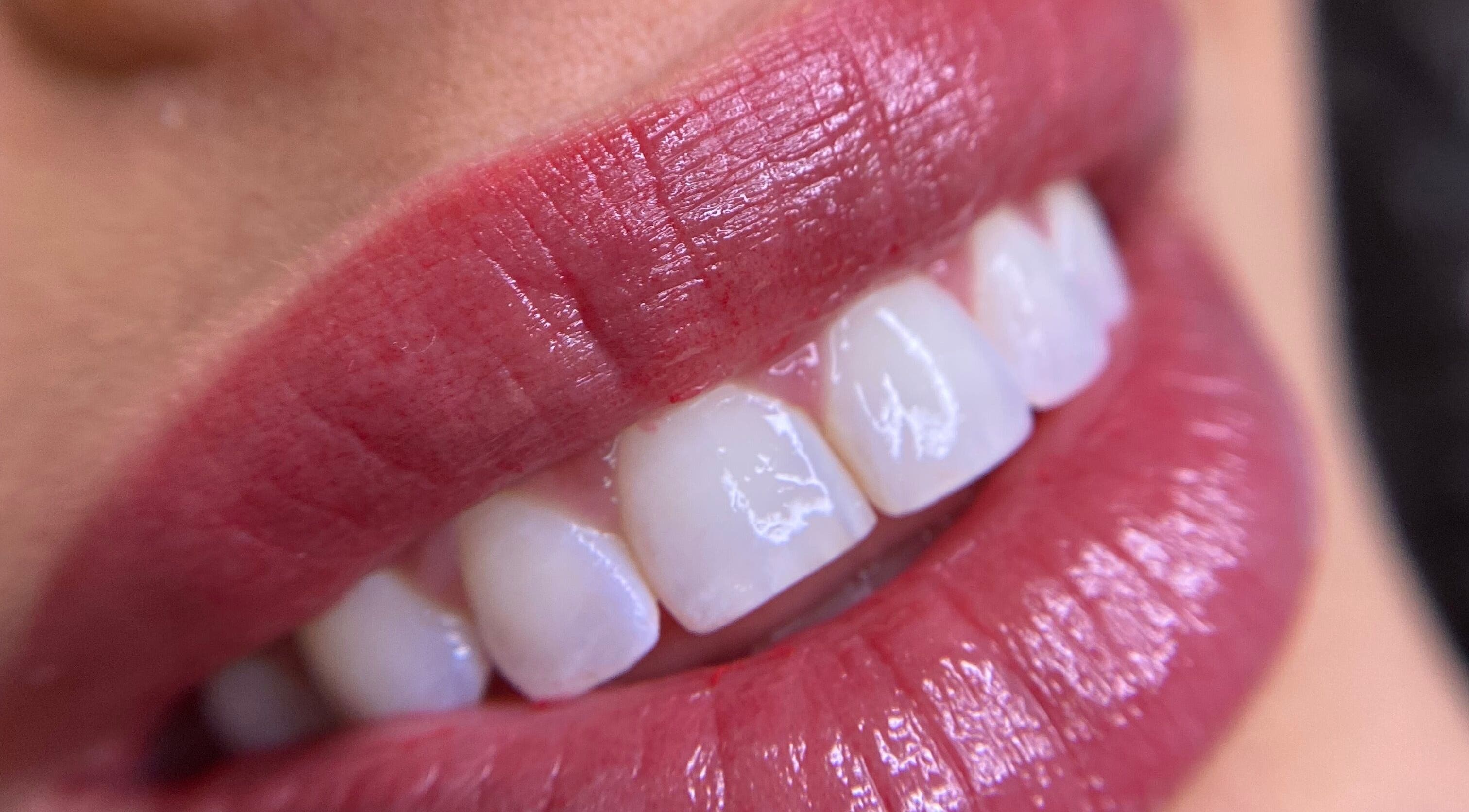 Close de lábios e dentes brilhantes no Kamille Macagnani, Porto, Porto, PT.