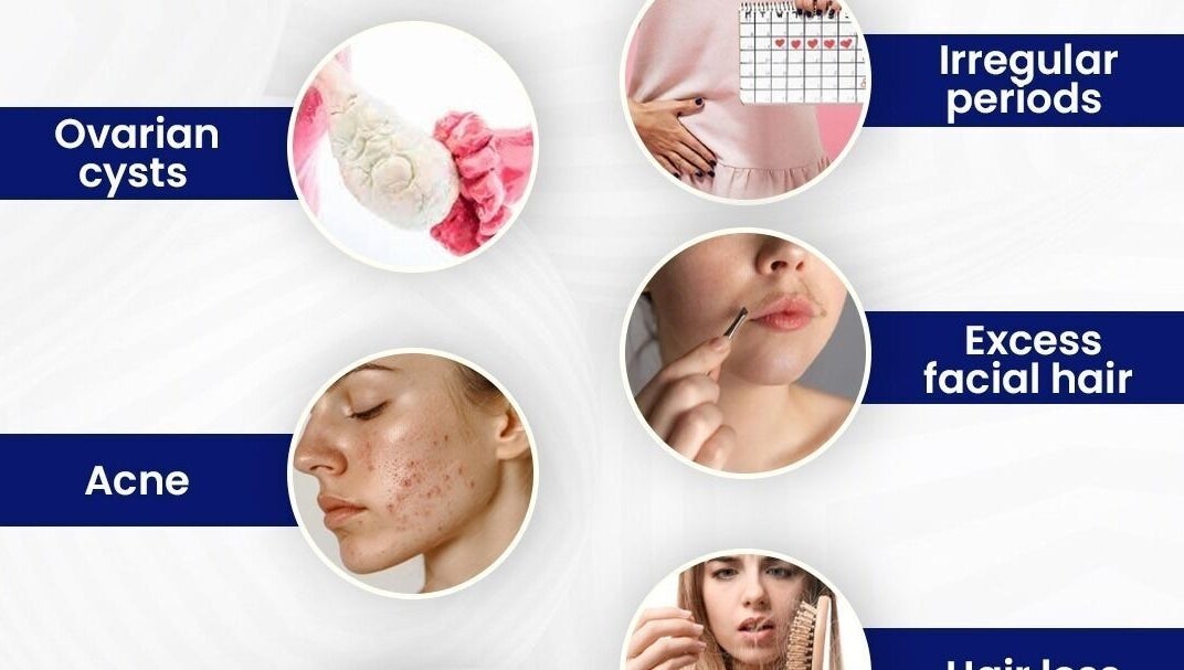 ReLive Homeopathy in Lucknow offers remedies for ovarian cysts, acne, and hair loss. Visit Dr. Nadeem Khan for solutions.