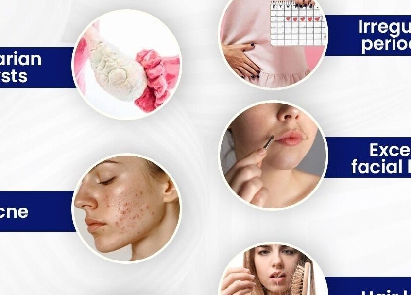 ReLive Homeopathy in Lucknow offers remedies for ovarian cysts, acne, and hair loss. Visit Dr. Nadeem Khan for solutions.