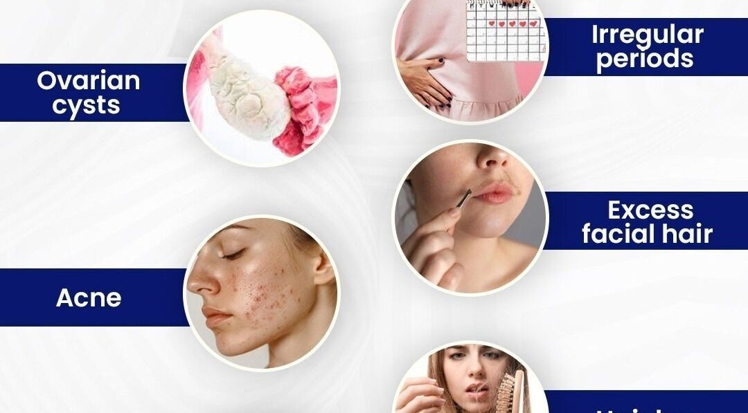 ReLive Homeopathy in Lucknow offers remedies for ovarian cysts, acne, and hair loss. Visit Dr. Nadeem Khan for solutions.