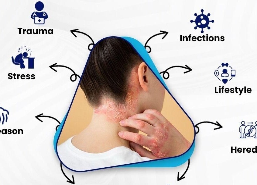 ReLive Homeopathy- Dr Nadeem Khan in Lucknow shows skin issues linked to stress, trauma, infections, lifestyle.