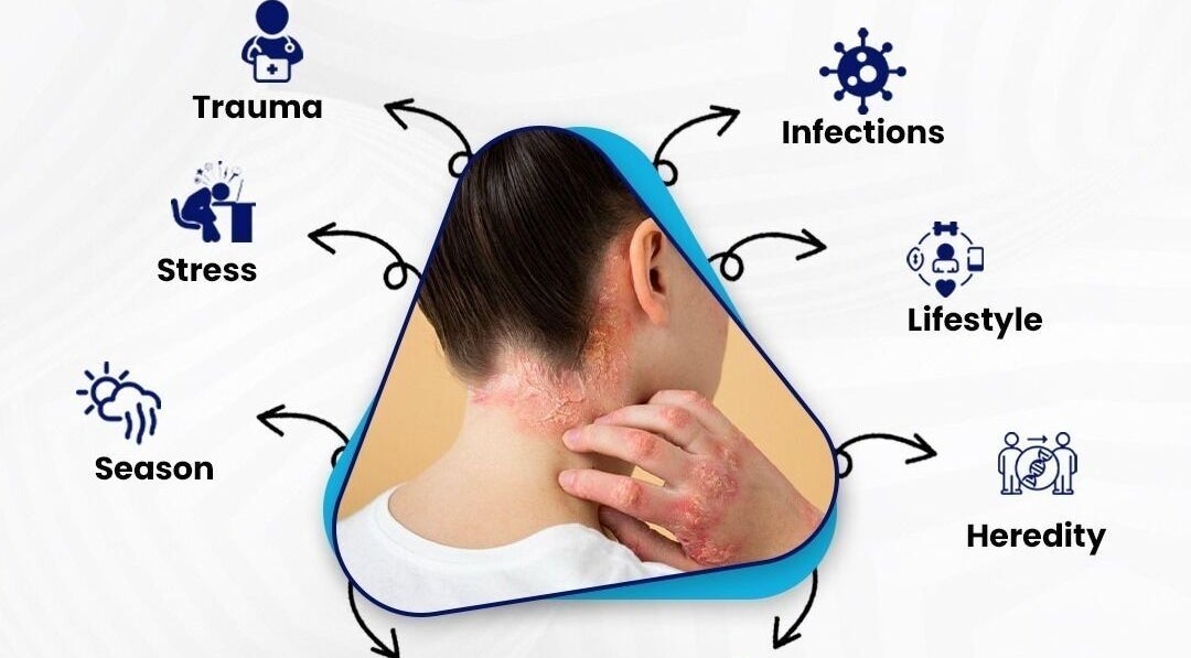 ReLive Homeopathy- Dr Nadeem Khan in Lucknow shows skin issues linked to stress, trauma, infections, lifestyle.