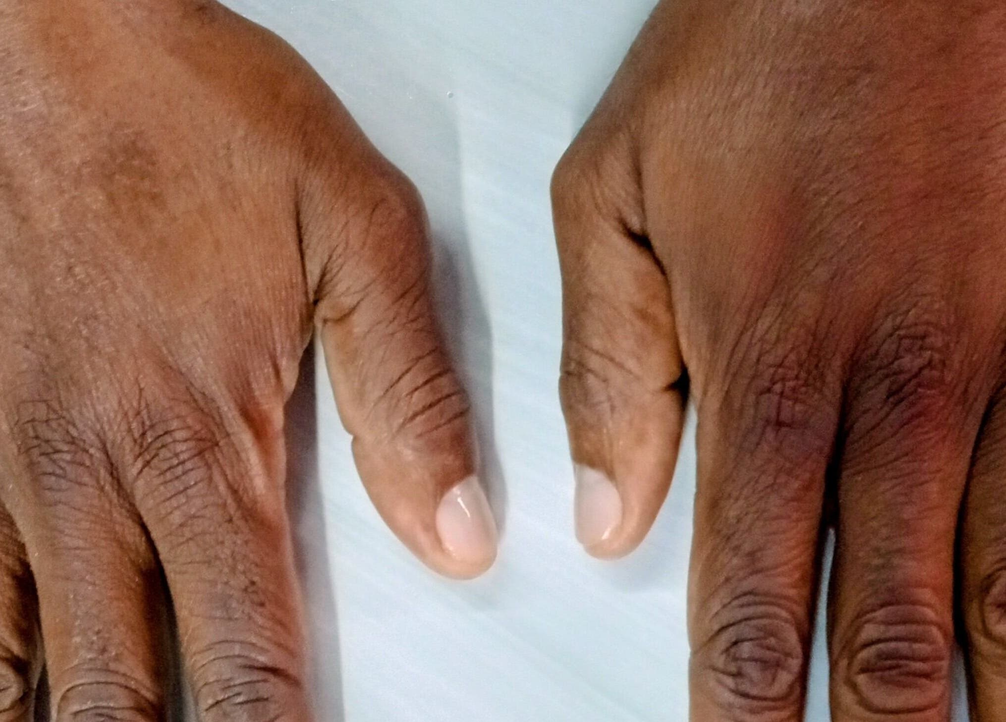 Hands showing manicure at Adia Hair Braiding and More in Miami, Florida, US.