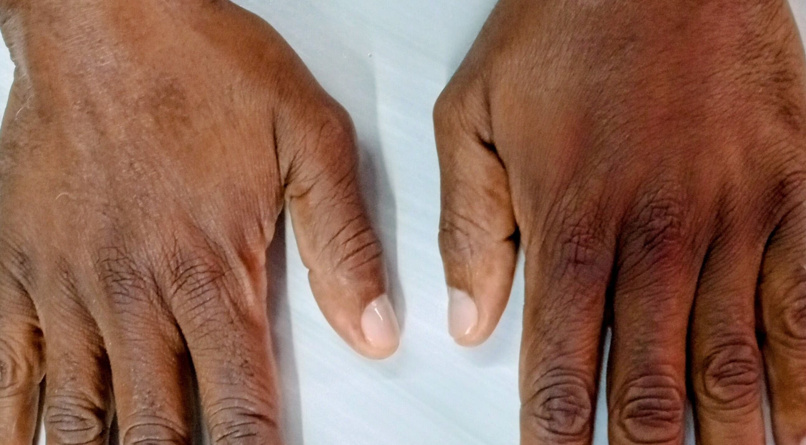 Hands showing manicure at Adia Hair Braiding and More in Miami, Florida, US.