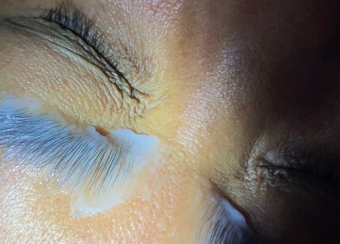 Close-up of a lash treatment in progress at NĀSKIN, Cape Town, Western Cape, ZA, enhancing natural beauty.
