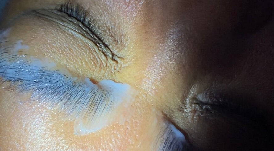 Close-up of a lash treatment in progress at NĀSKIN, Cape Town, Western Cape, ZA, enhancing natural beauty.