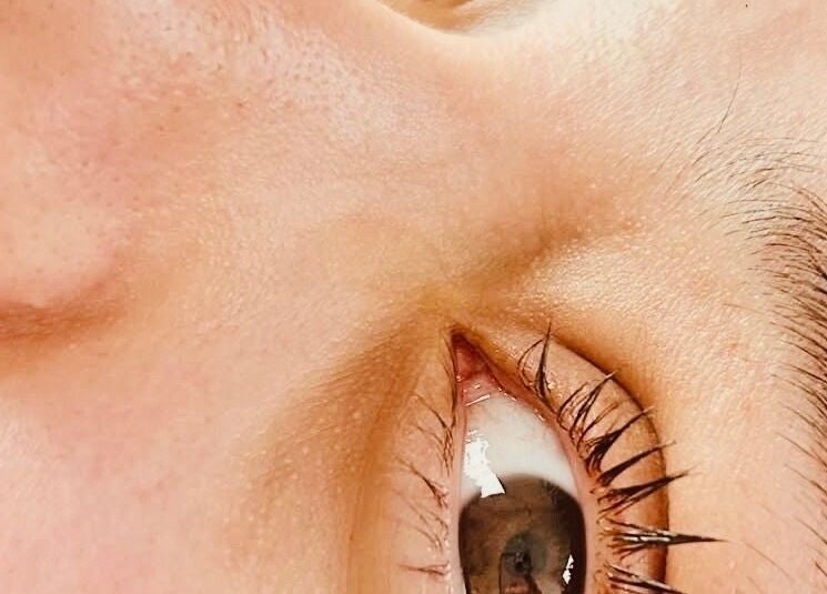 Close-up of eye treatment at Apapacho Studio, Clearwater, Florida, US. Enhancing beauty and wellness naturally.