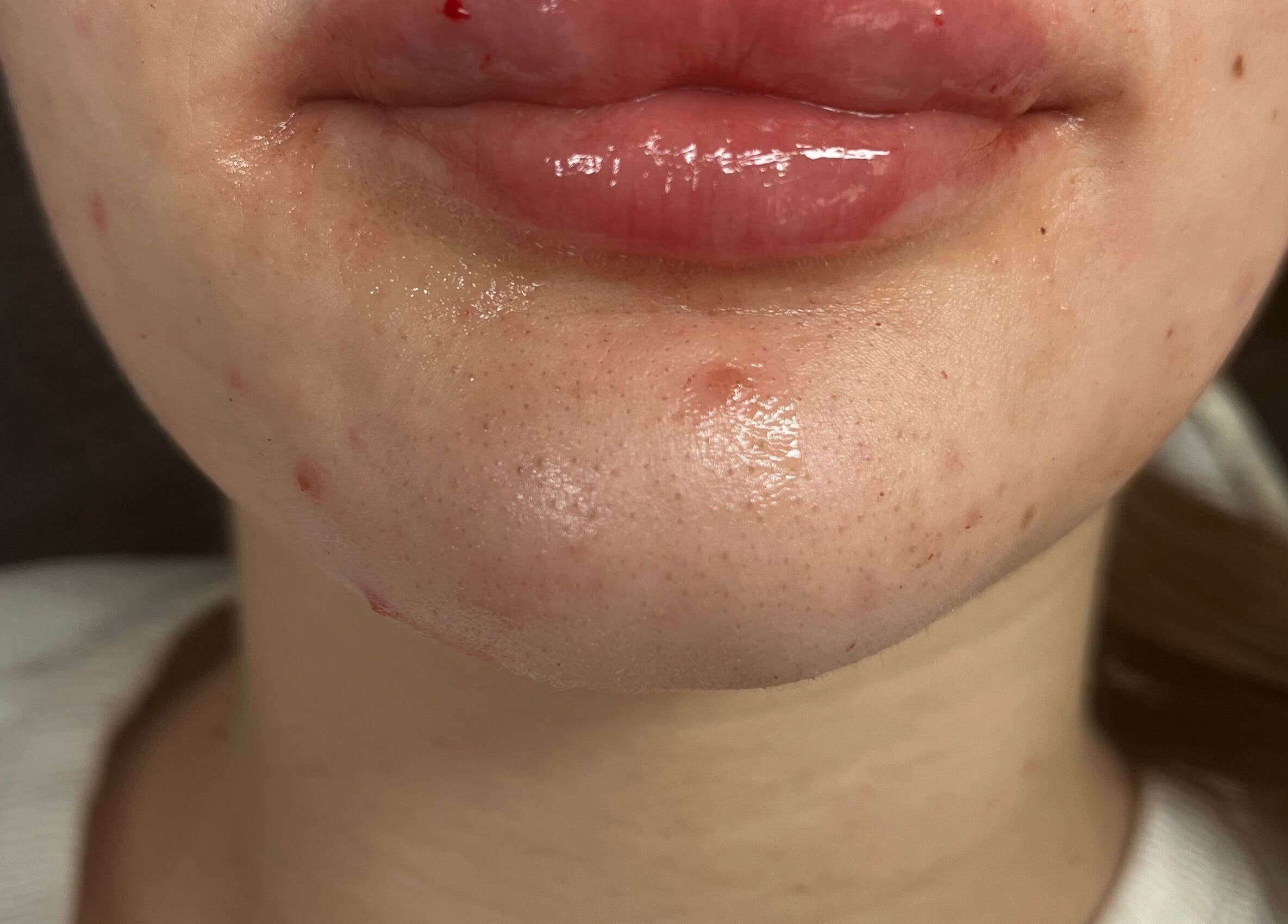 Close-up of glossy lips and skin care at Angeljojoaesthetics, Liverpool, England, GB.