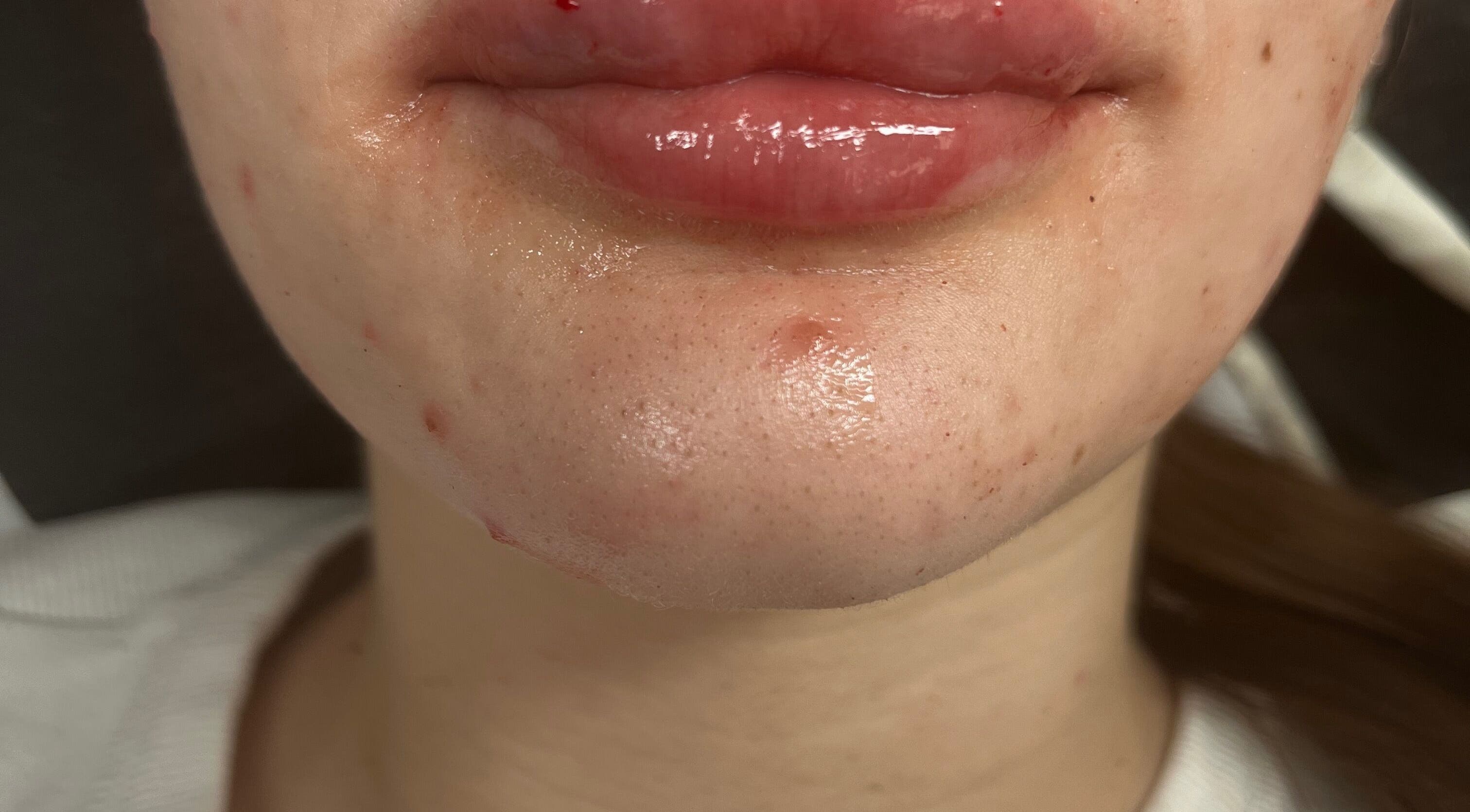 Close-up of glossy lips and skin care at Angeljojoaesthetics, Liverpool, England, GB.