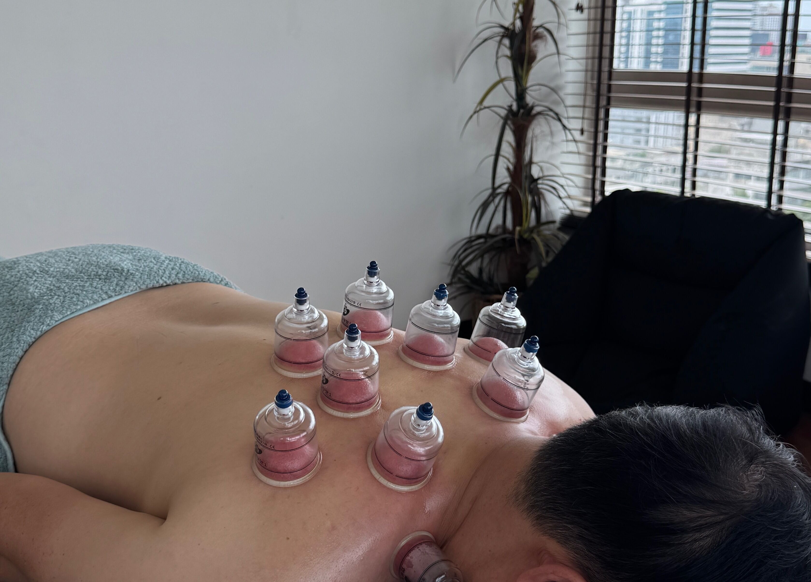 Cupping therapy at Soulistic, Krung Thep Maha Nakhon, offering relaxation and wellness in a serene setting.