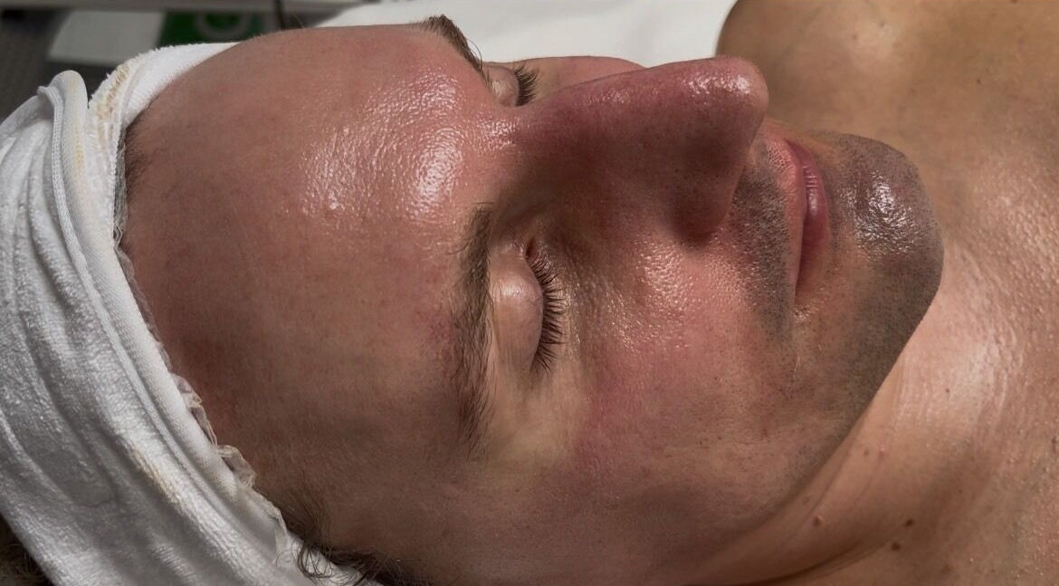 Facial treatment at Seeing Stars Skin in London, England, GB. Person with serene expression and glowing skin.