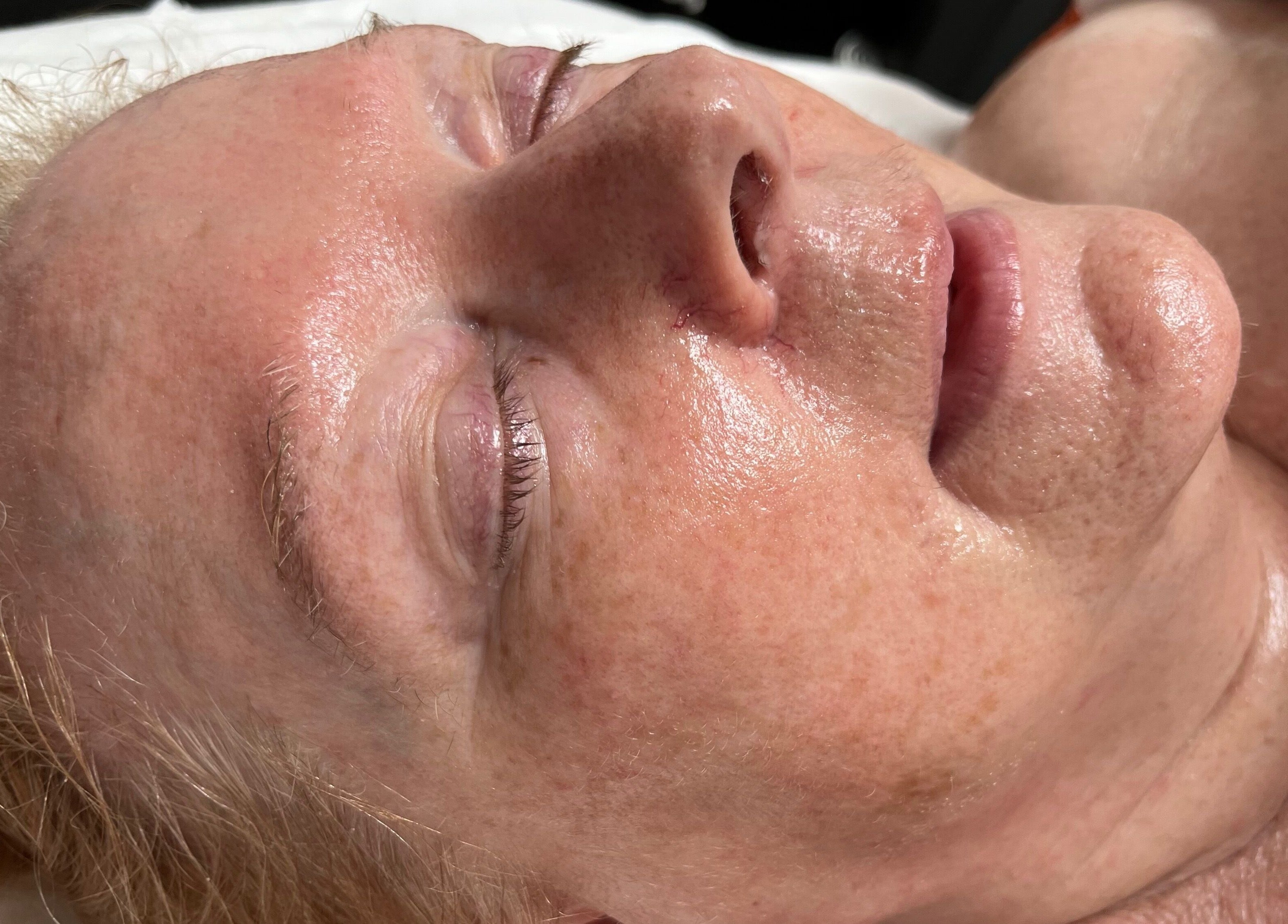 Relaxed client enjoying a facial treatment at Seeing Stars Skin in London, England, GB. Glowing and rejuvenated skin.