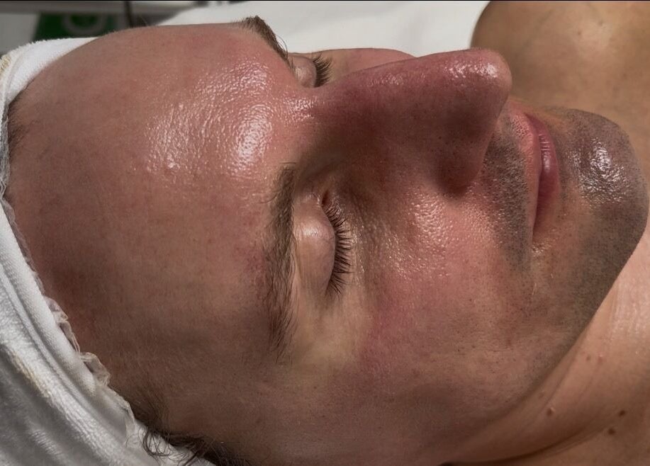 Facial treatment at Seeing Stars Skin in London, England, GB showcasing rejuvenated and relaxed skin.