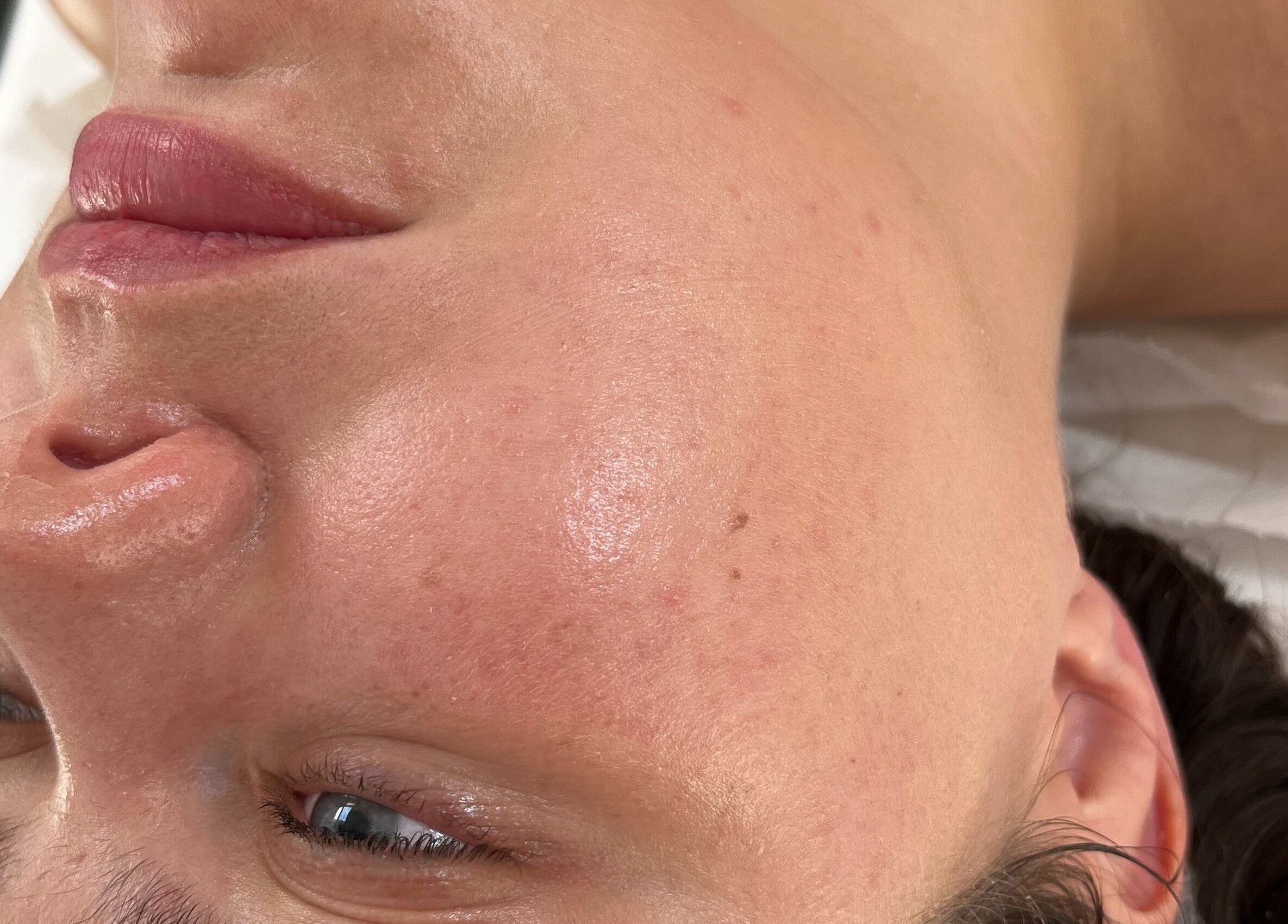 Close-up of a smooth facial complexion at Seeing Stars Skin, London, England, GB.