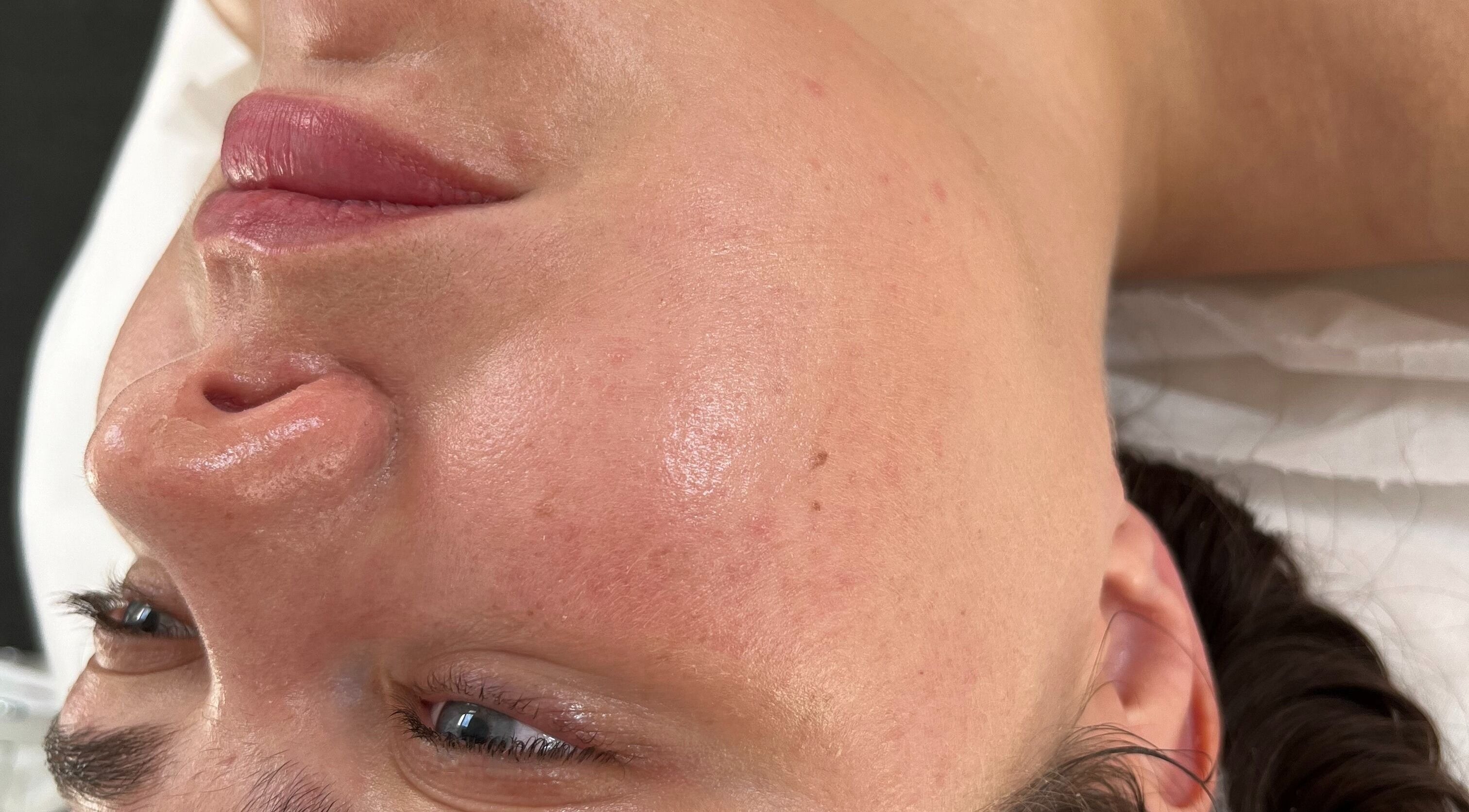 Close-up of a smooth facial complexion at Seeing Stars Skin, London, England, GB.