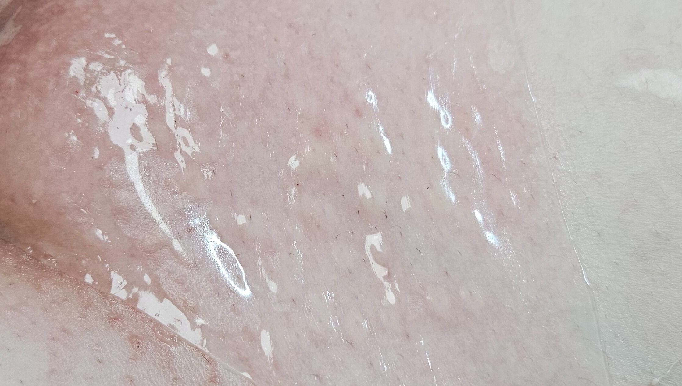 Close-up of glowing skin after treatment at IYL VIBRANT SKIN STUDIO, El Paso, Texas, US.