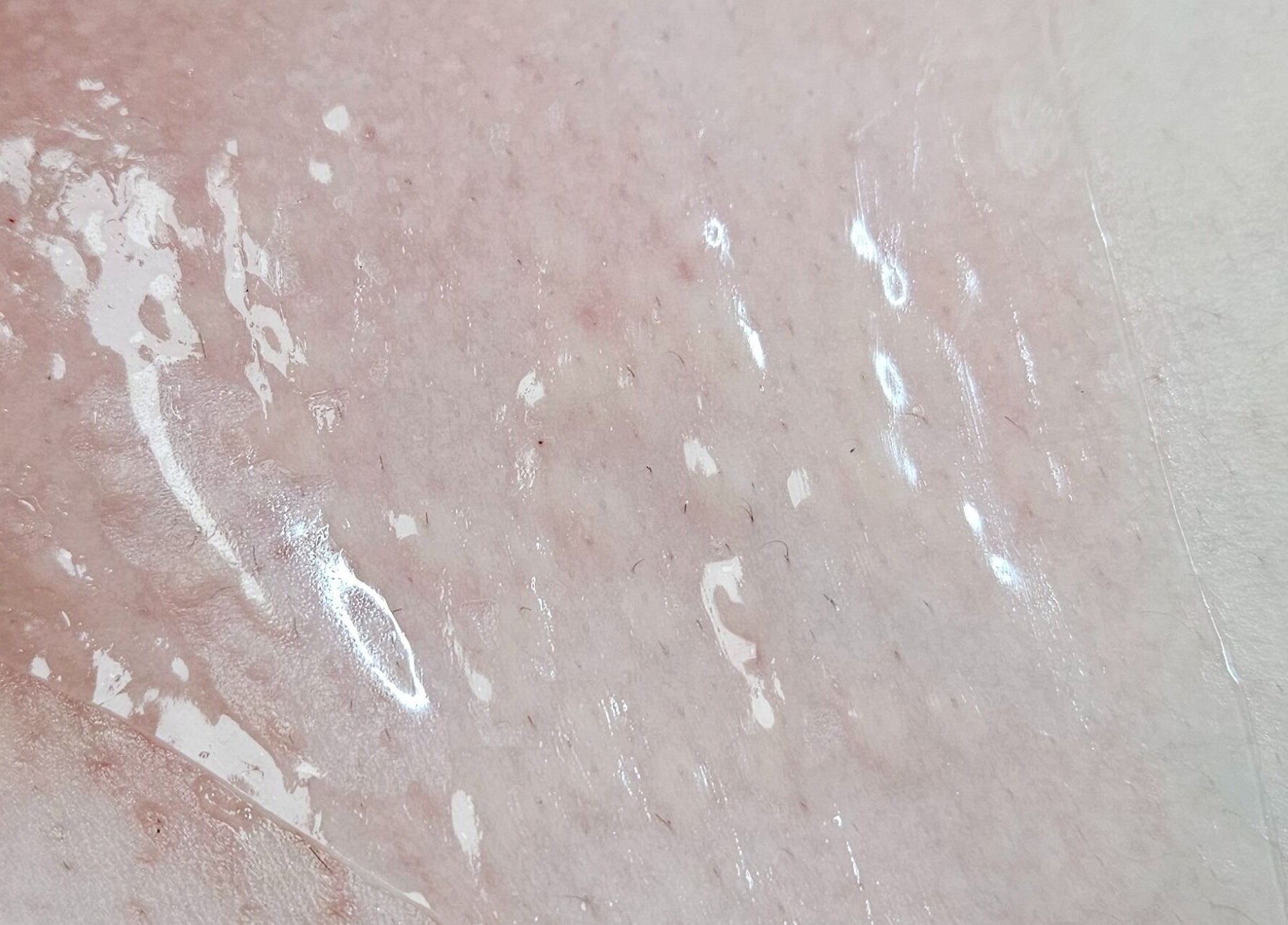 Close-up of glowing skin after treatment at IYL VIBRANT SKIN STUDIO, El Paso, Texas, US.