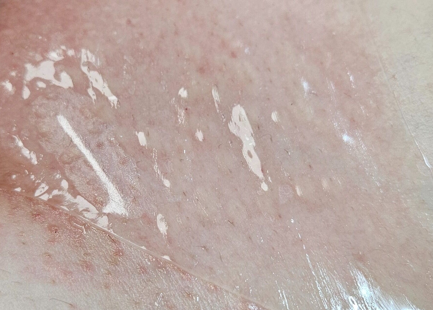 Skin rejuvenation treatment at IYL VIBRANT SKIN STUDIO, El Paso, Texas, US for a smooth glowing finish.