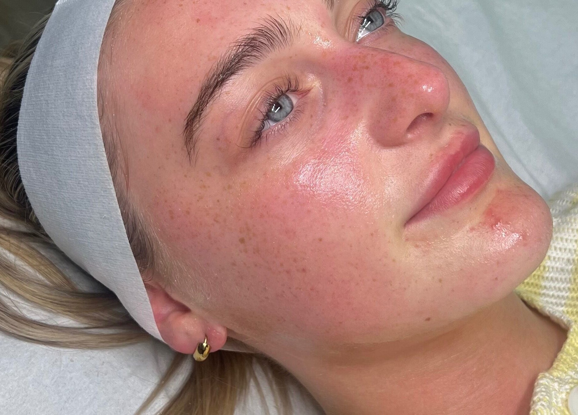 Client enjoying a radiant skin treatment at Pure Serenity Skin, Leeds, England, GB.