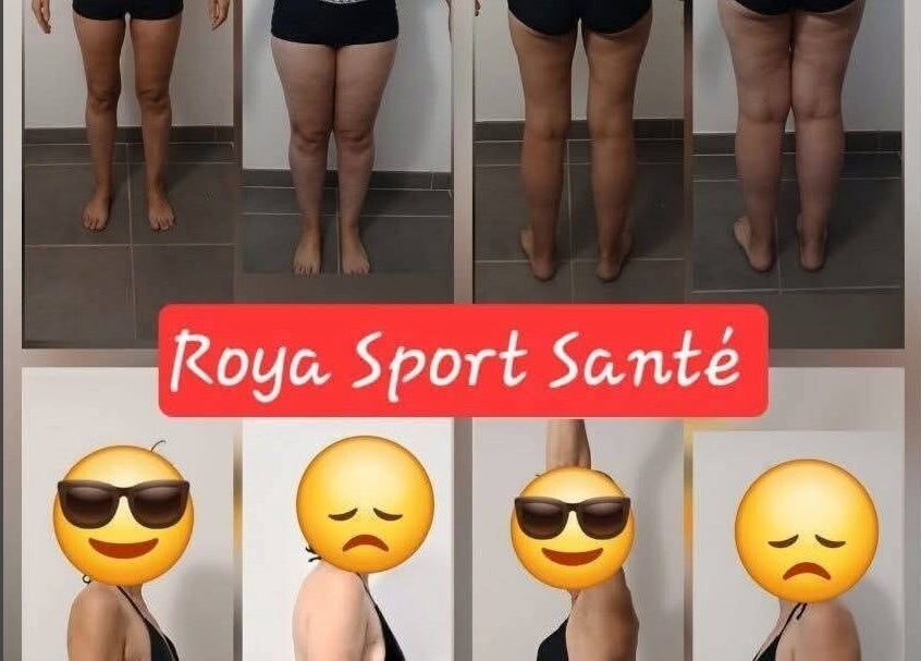 Comparaison avant-après silhouette à Roya Sport Santé, Breil sur roya, Provence-alpes-côte D'azur, FR.