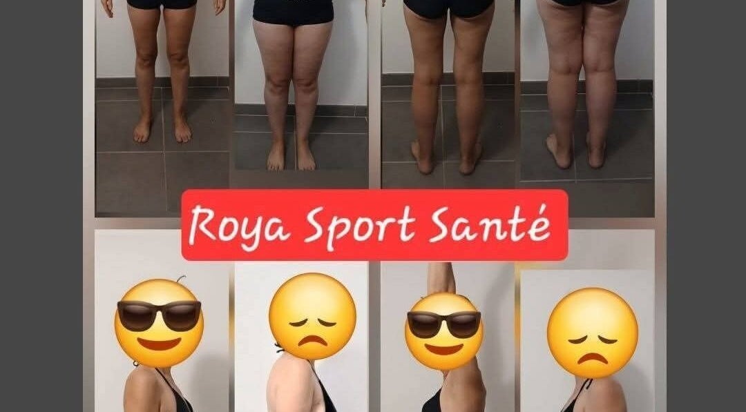 Comparaison avant-après silhouette à Roya Sport Santé, Breil sur roya, Provence-alpes-côte D'azur, FR.