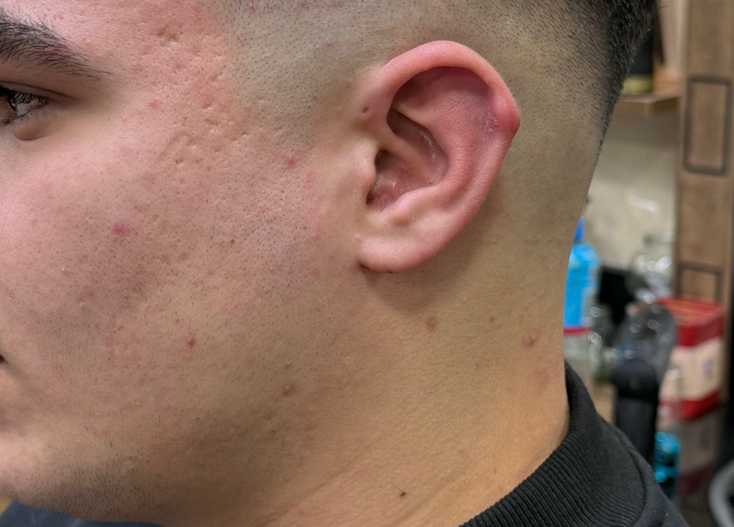 Close-up of skin fade haircut at Rayan Barber, Liverpool, England, GB showcasing precision and style.