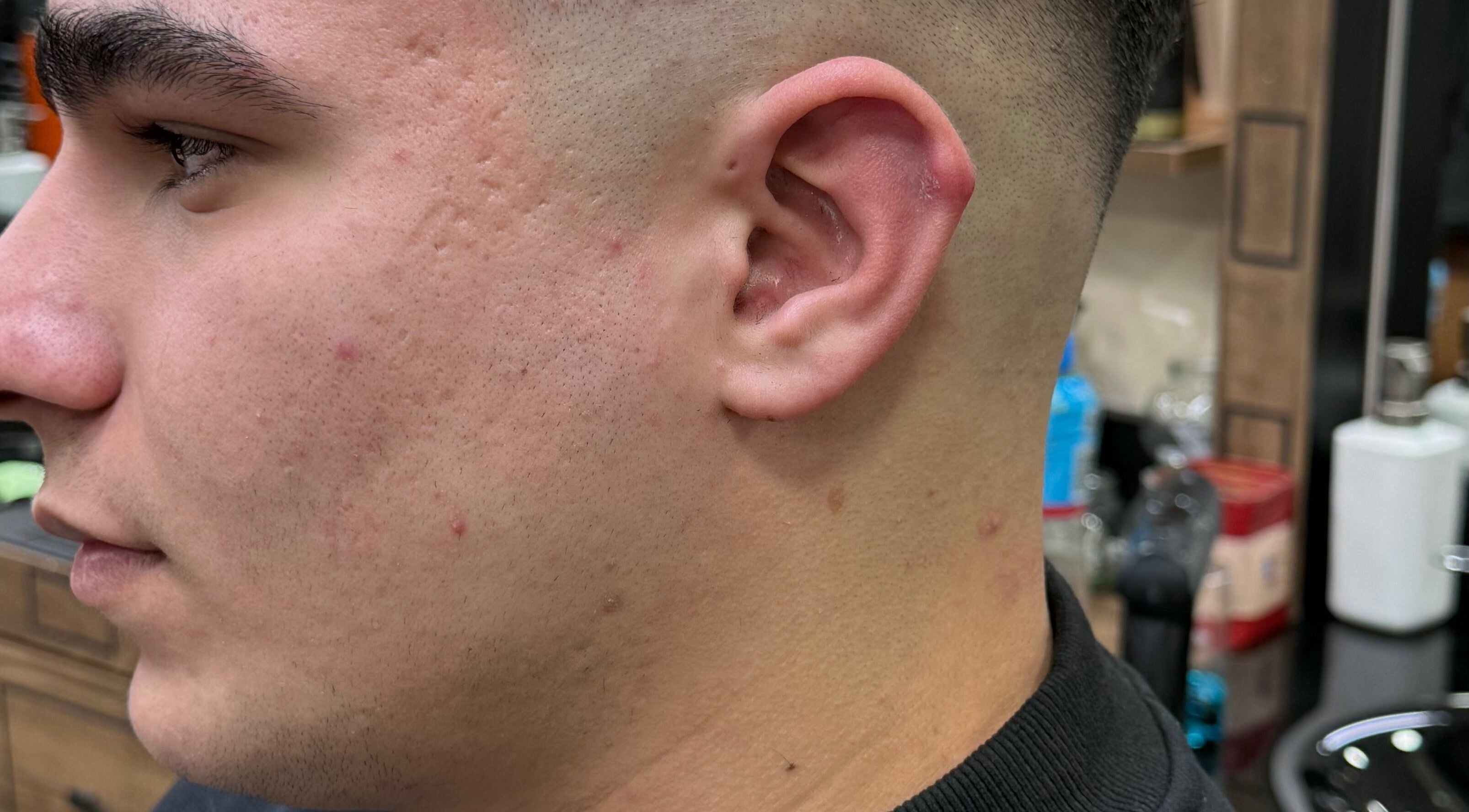 Close-up of skin fade haircut at Rayan Barber, Liverpool, England, GB showcasing precision and style.