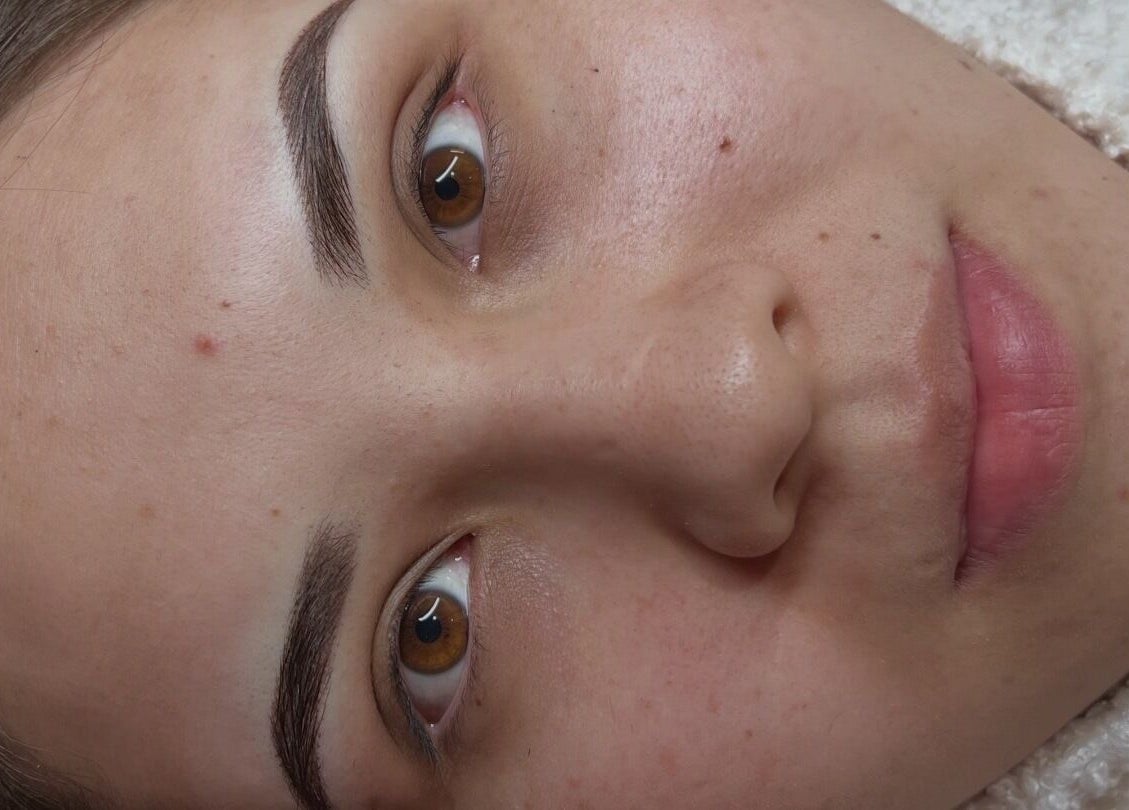 Close-up of woman's glowing skin at VIP Beauty Studio, Sherwood Park, Alberta, CA.