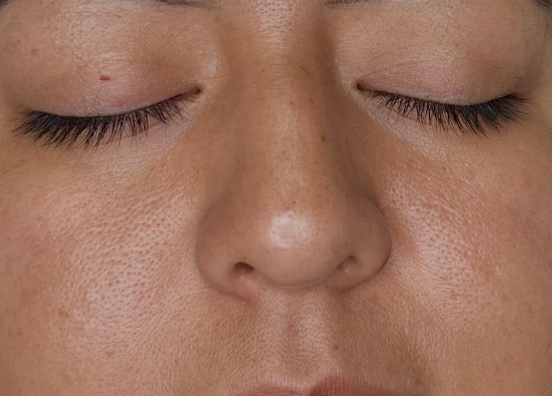 Close-up of a serene face showcasing skin texture at VIP Beauty Studio, Sherwood Park, Alberta, CA.