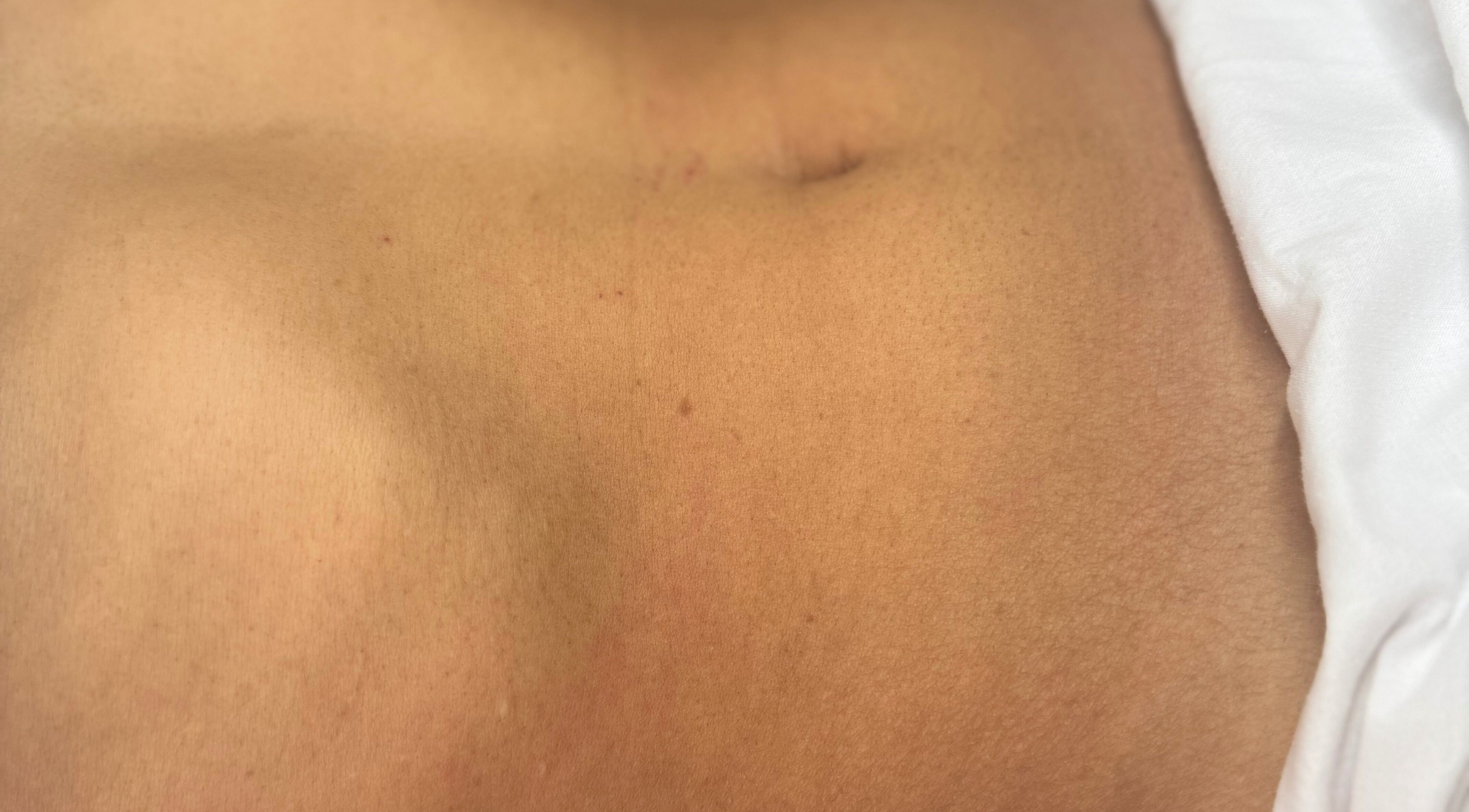 Close-up of smooth skin after treatment at Serene Clinic - Advance Aesthetics, Paramaribo, Paramaribo, SR.