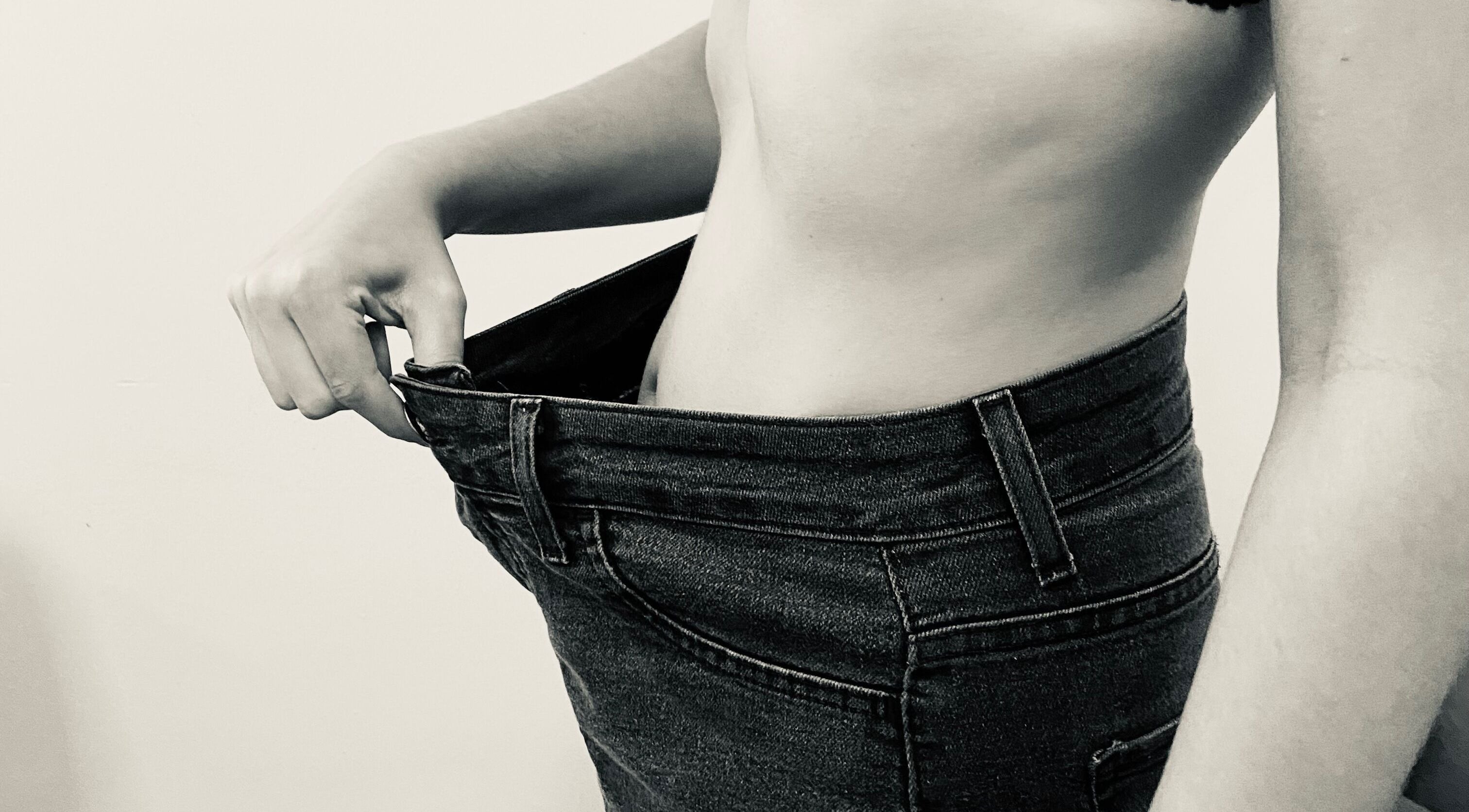 Imagem de perda de peso no Beatriz Rocha estética integrativa, São Paulo, São Paulo, BR.