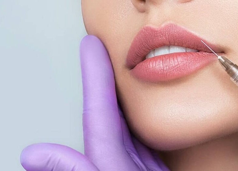 Dermal filler treatment at Aria Medical Aesthetics, Toronto, Ontario, CA, enhancing lip volume with precision.