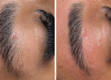 Before and after brow treatment at KV Skin Studio (Gilbert), Gilbert, Arizona, US, showing enhanced fullness.