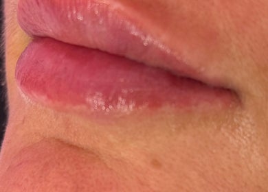 Glossy lips treatment at Cherry Blossom Beauty, Thornaby, England, GB, showcasing natural enhancement.