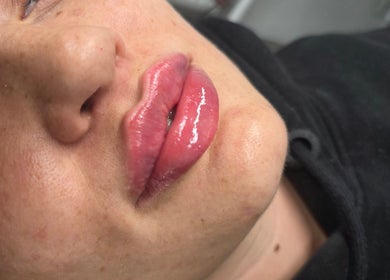 Close-up of glossy lips at Aesthetics and Beauty by Natalia, Edinburgh, Scotland, GB.
