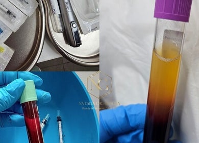 Medical and beauty tools at Aesthetics and Beauty by Natalia, Edinburgh, Scotland, GB, showcasing advanced beauty care.