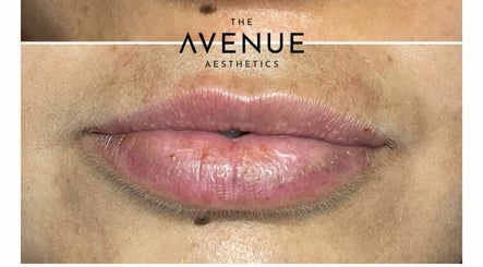 The Avenue Aesthetics – obraz 3