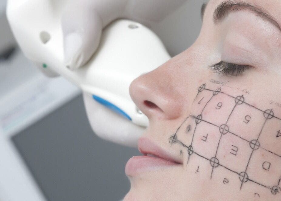 Tratamiento facial en WCL. Wellness Clinic León. Medicina Estética, León, Castilla y León, ES.