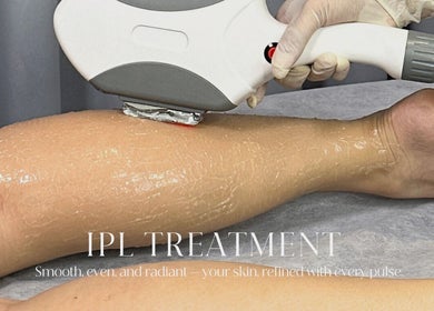 IPL treatment at SoiRee Citraland, East Java, ID, enhancing silky smooth skin.