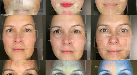 Smart Skin Expert Skin and Laser Clinic billede 3
