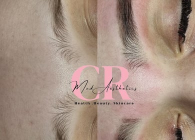 Close-up skincare results at Healing Hands Beauty, Randfontein, Gauteng, ZA; smooth, rejuvenated skin.