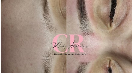 Close-up skincare results at Healing Hands Beauty, Randfontein, Gauteng, ZA; smooth, rejuvenated skin.