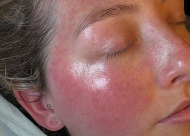 Close-up of a radiant complexion after skincare at Lovelli Salon & Training Academy, Halfway, England, GB.