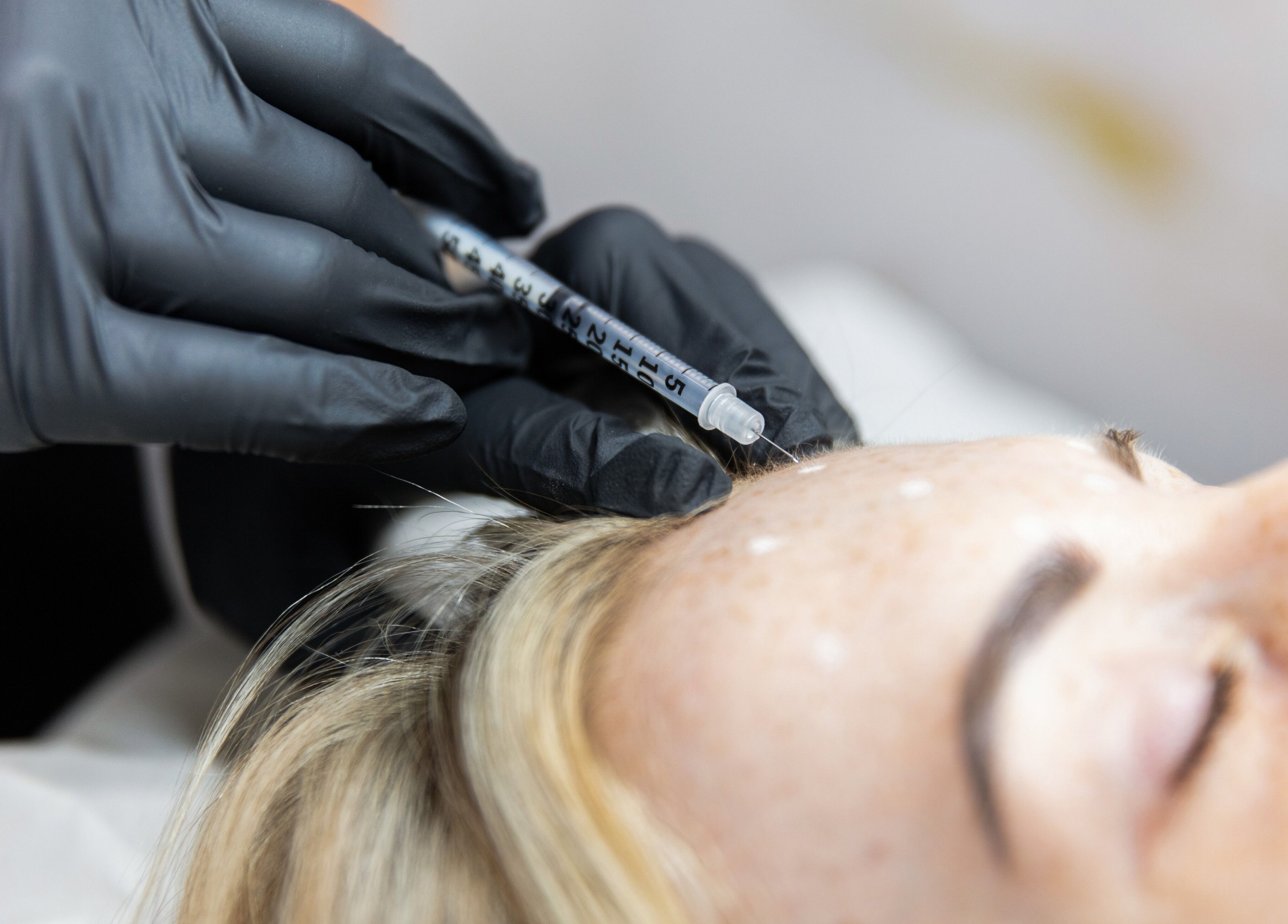 Close-up of facial treatment at Charlotte Taylor Permanent Makeup Leeds Clinic, Yeadon, England, GB.