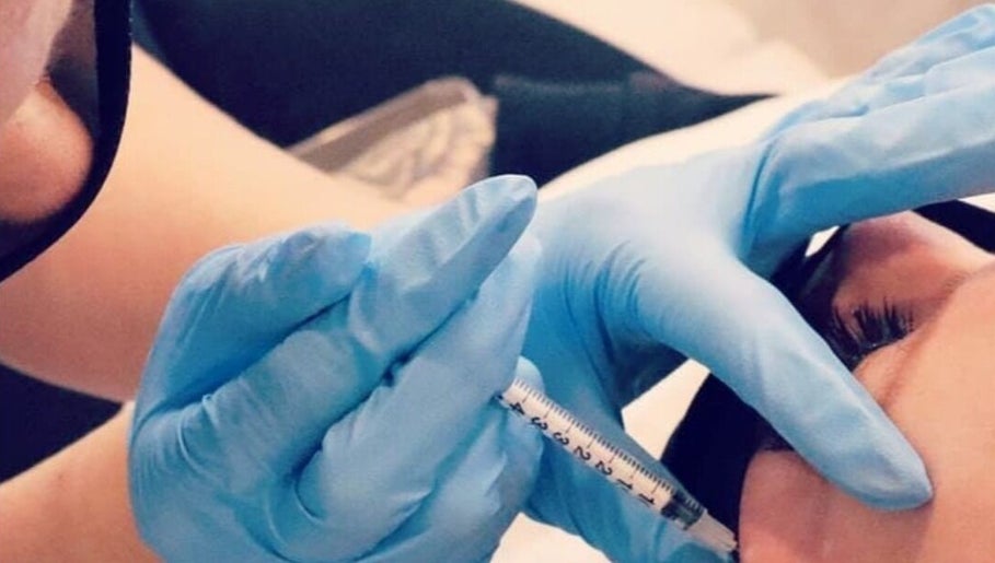 Professional filler treatment at 11:11 Beauty and Aesthetics, Highbridge, England, GB.
