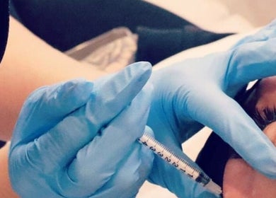 Professional filler treatment at 11:11 Beauty and Aesthetics, Highbridge, England, GB.