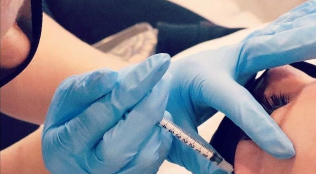 Professional filler treatment at 11:11 Beauty and Aesthetics, Highbridge, England, GB.